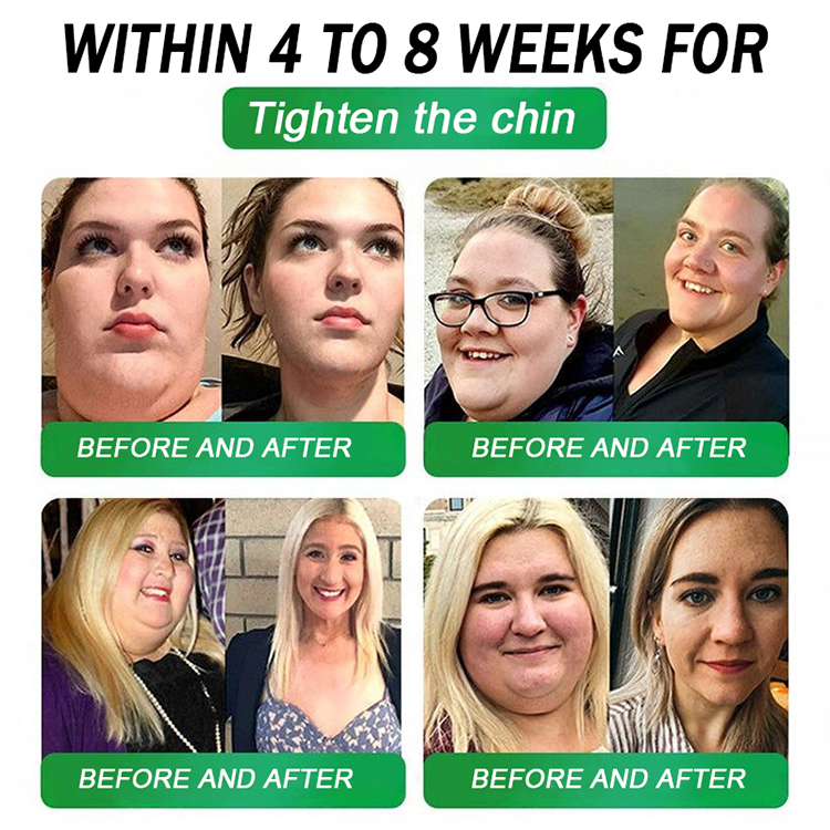 FDA Mall | Natravor® 8-in-1 Slim & Healthy Oral Solution (Once a day, results in 7 days), With 100 Billion CFU Active Probiotics ✅ Supports weight management, heart health, diabetes, gut & women’s health, while firming skin & boosting energy.