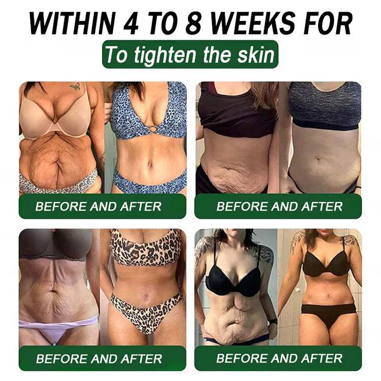 FDA Mall | Natravor® 8-in-1 Slim & Healthy Oral Solution (Once a day, results in 7 days), With 100 Billion CFU Active Probiotics ✅ Supports weight management, heart health, diabetes, gut & women’s health, while firming skin & boosting energy.