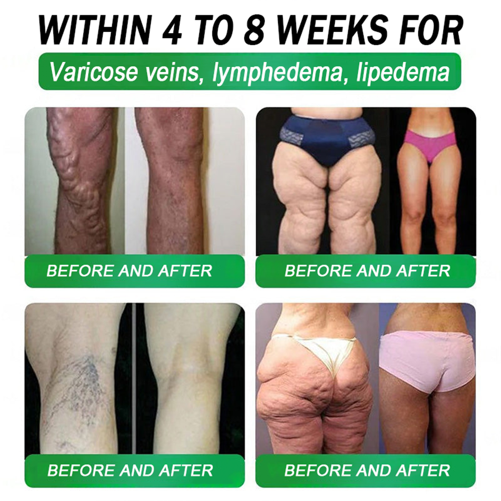FDA Mall | Natravor® 8-in-1 Slim & Healthy Oral Solution (Once a day, results in 7 days), With 100 Billion CFU Active Probiotics ✅ Supports weight management, heart health, diabetes, gut & women’s health, while firming skin & boosting energy.