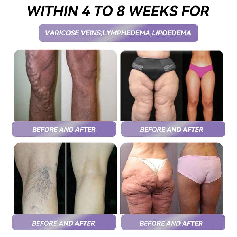 𝗡𝗮𝘁𝗿𝗮𝘃𝗼𝗿® 𝗦𝗹𝗶𝗺𝗺𝗶𝗻𝗴 𝗗𝗿𝗼𝗽𝘀👨‍⚕️ - 𝗢𝗯𝗲𝘀𝗶𝘁𝘆, 𝗖𝗮𝗿𝗱𝗶𝗼𝘃𝗮𝘀𝗰𝘂𝗹𝗮𝗿 𝗗𝗶𝘀𝗲𝗮𝘀𝗲, 𝗗𝗶𝗮𝗯𝗲𝘁𝗲𝘀, 𝗦𝗹𝗲𝗲𝗽 𝗔𝗽𝗻𝗲𝗮, 𝗝𝗼𝗶𝗻𝘁 𝗣𝗿𝗼𝗯𝗹𝗲𝗺𝘀 𝗮𝗻𝗱 𝗠𝗼𝗿𝗲