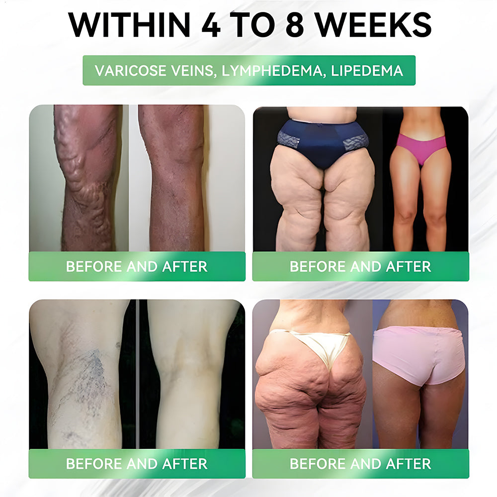 𝑵𝒂𝒕𝒓𝒂𝒗𝒐𝒓® 8-𝒊𝒏-1 𝙁𝙞𝙩 & 𝙑𝙞𝙩𝙖𝙡 𝖮𝗋𝖺𝗅 𝙎𝙤𝙡𝙪𝙩𝙞𝙤𝙣 (𝑱𝒖𝒔𝒕 𝒐𝒏𝒄𝒆 𝒂 𝒅𝒂𝒚, 𝒗𝒊𝒔𝒊𝒃𝒍𝒆 𝒄𝒉𝒂𝒏𝒈𝒆𝒔 𝒊𝒏 7 𝒅𝒂𝒚𝒔) ✅ 𝑭𝒐𝒓 𝒐𝒃𝒆𝒔𝒊𝒕𝒚, 𝒄𝒂𝒓𝒅𝒊𝒐𝒗𝒂𝒔𝒄𝒖𝒍𝒂𝒓 𝒉𝒆𝒂𝒍𝒕𝒉, 𝒅𝒊𝒂𝒃𝒆𝒕𝒆𝒔, 𝒔𝒍𝒆𝒆𝒑 𝒂𝒑𝒏𝒆𝒂, 𝒈𝒖𝒕 𝒉𝒆𝒂𝒍𝒕𝒉, 𝒋𝒐𝒊𝒏𝒕 𝒊𝒔𝒔𝒖𝒆𝒔, 𝒂𝒏𝒅 𝒎𝒐𝒓𝒆